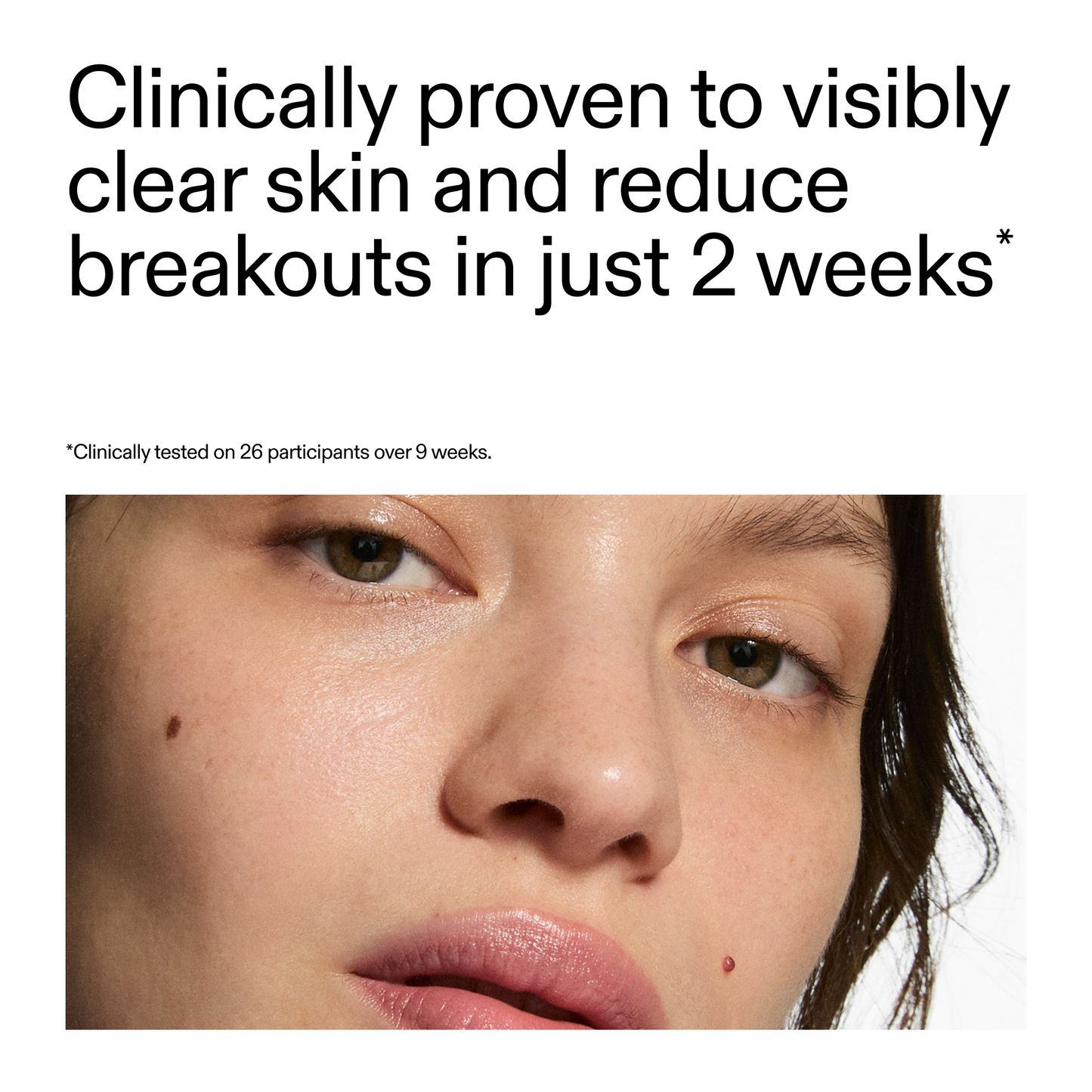 360-acne-clearing-duo-s9 360_Serum_Key_Claim.png