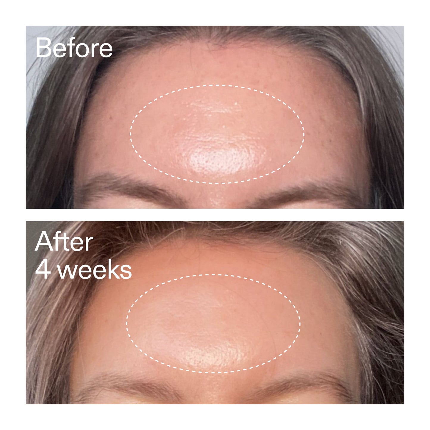 advanced-0-2-retinal-serum-duo-p7 AdvancedRetinal_BeforeAfter1_2000x2000_4e9c798a-f30e-45b8-a34a-7c4740f2f2cb.jpg