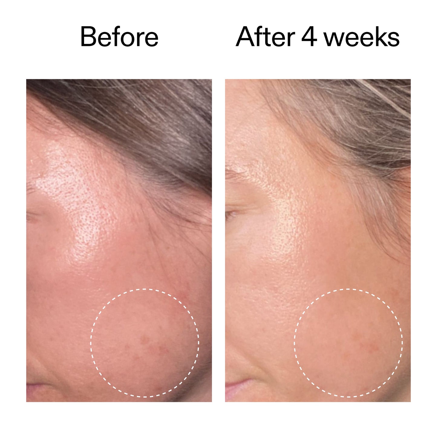 advanced-0-2-retinal-serum-duo-p7 AdvancedRetinal_BeforeAfter2__2000x2000_8ef75542-2316-4814-81ee-0f66a85912bc.jpg