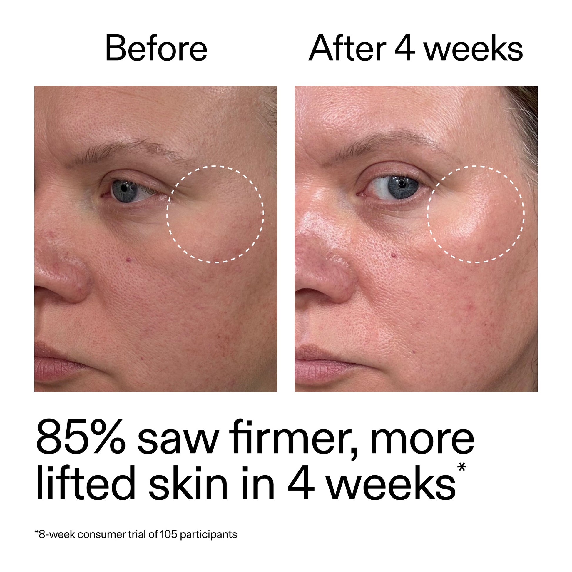 advanced-0-2-retinal-serum-duo-p7 AdvancedRetinal_BeforeAfter_Claim1_2000x2000_3a315aa8-f408-4b33-bbeb-0d9209f98404.jpg