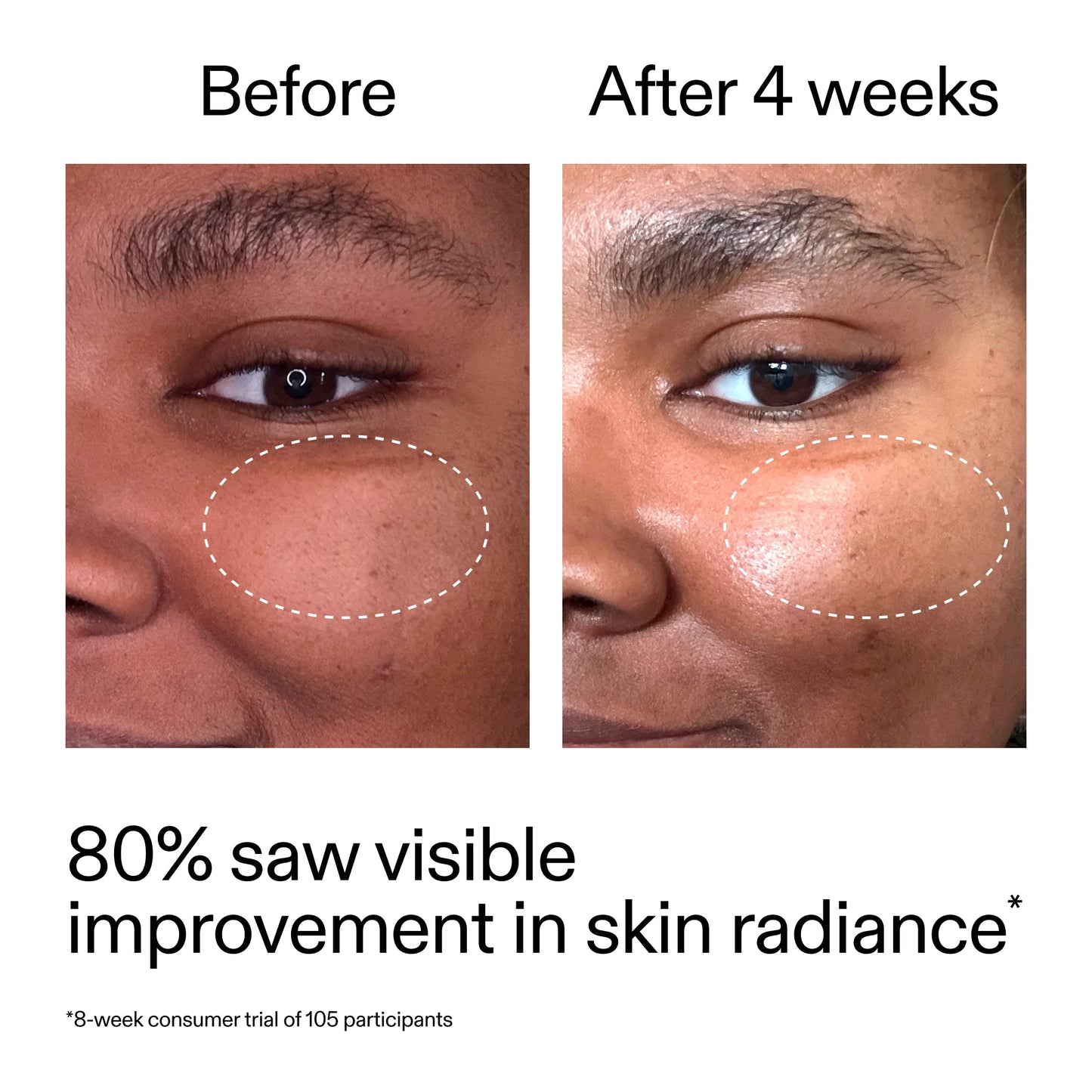 advanced-0-2-retinal-serum-duo-p7 AdvancedRetinal_BeforeAfter_Claim2_2000x2000_681b621d-8d44-4d44-9a40-89244f9b2e53.jpg