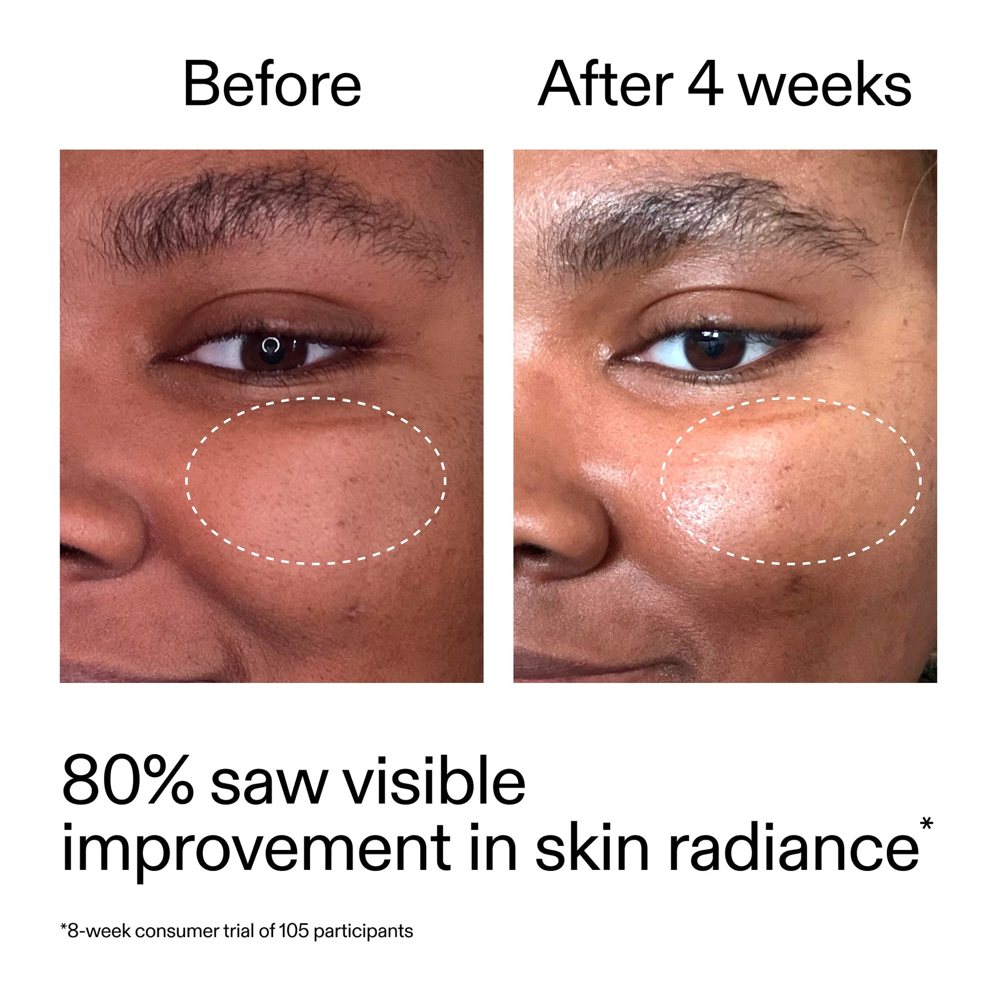 advanced-0-2-retinal-serum-duo-p7 AdvancedRetinal_BeforeAfter_Claim2_2000x2000_681b621d-8d44-4d44-9a40-89244f9b2e53.jpg