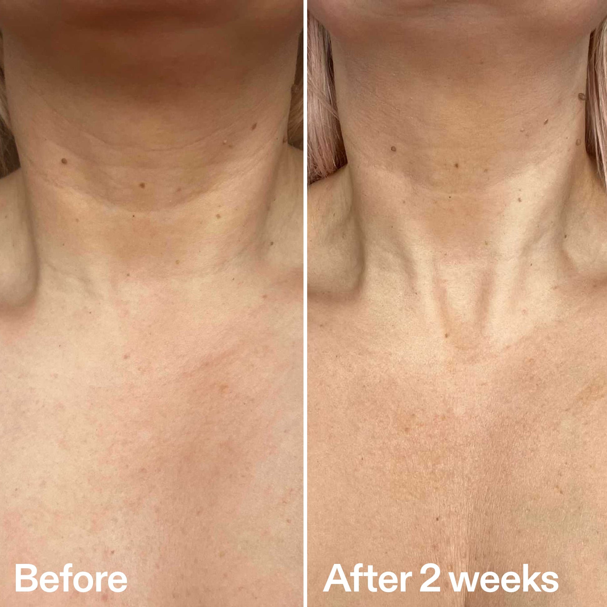 bio-active-neck-lift-stick-w3 B_A_2.jpg