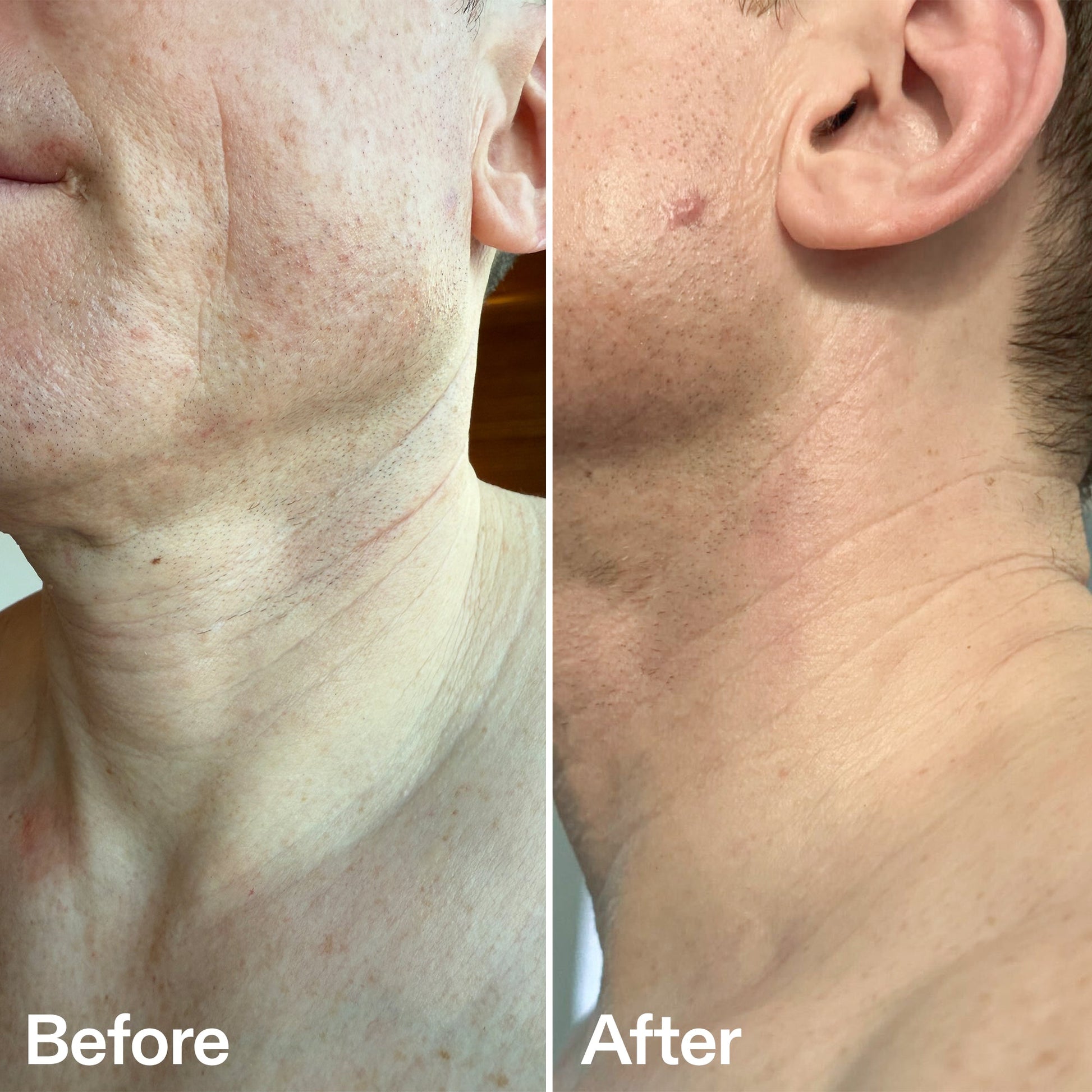 bio-active-neck-lift-stick-w3 B_A_afa2743e-b8e2-4504-92f4-e281cb6cf759.jpg