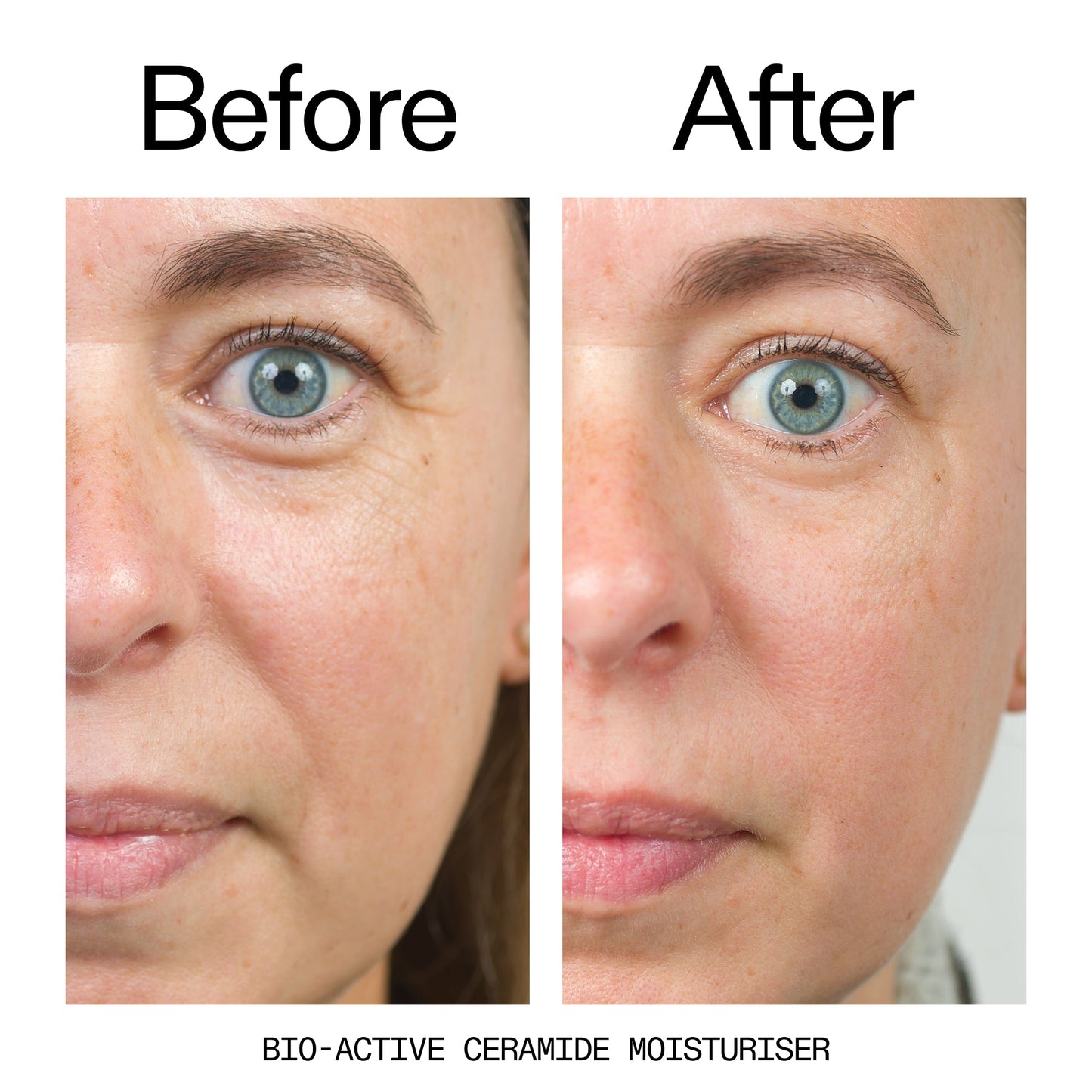 barrier-boosting-trio-z7 Bio-Active_Before_After_2000x2000_600947b4-e8c5-425a-9155-fc15bc83aa12.jpg
