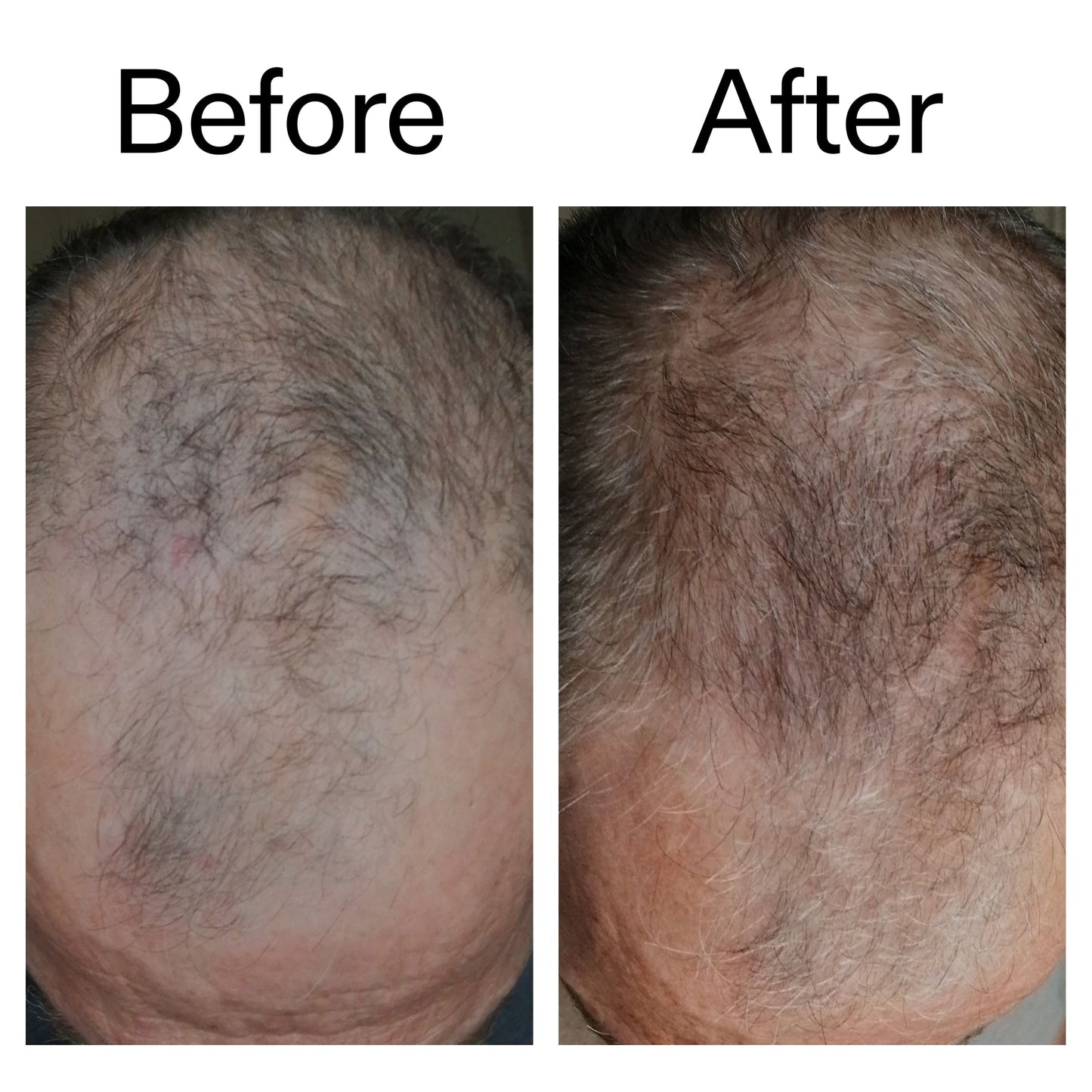3-month-hair-growth-trio-x0 Caffeine_Scalp_Treatment_B_A_Ppage_2000_x_2000.jpg