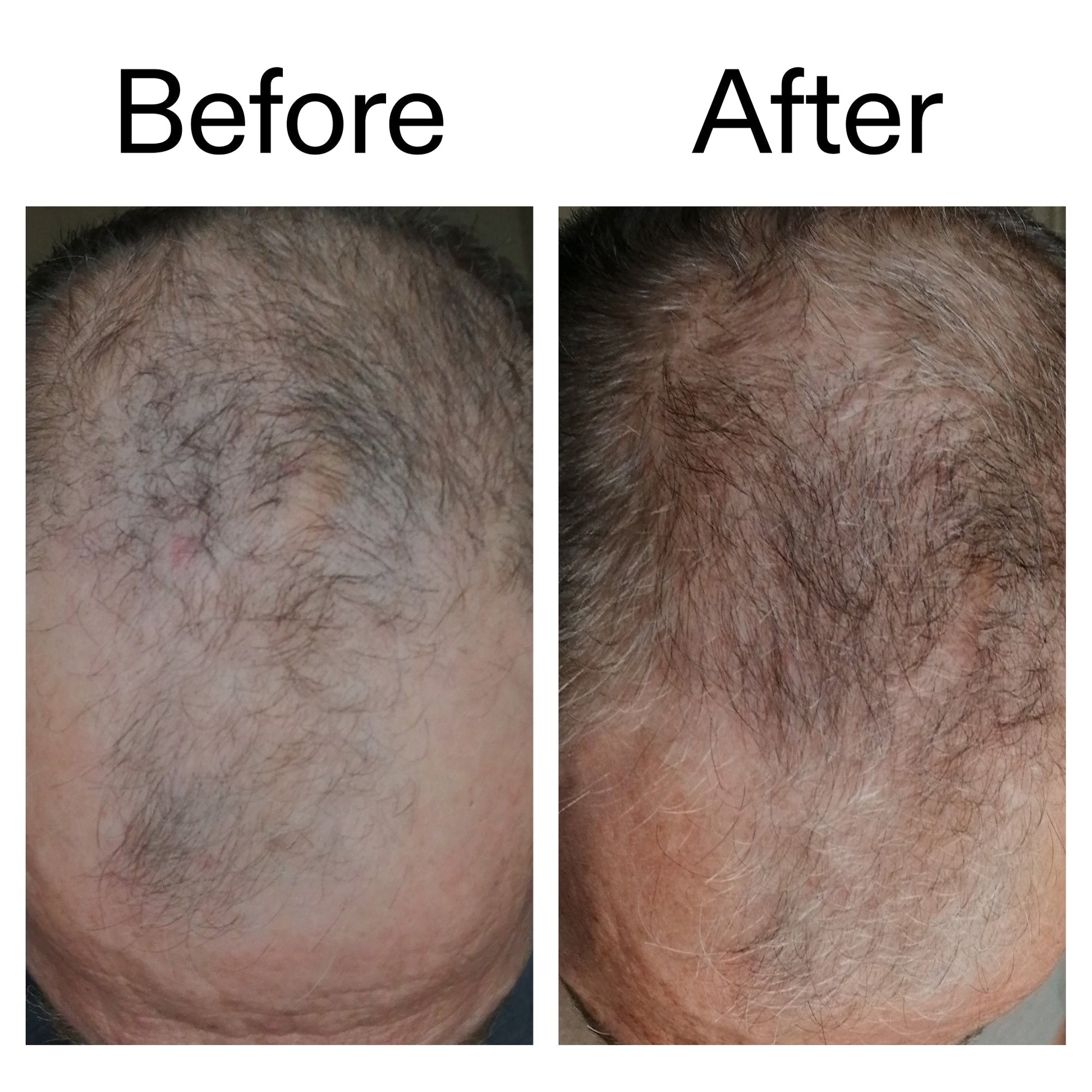 3-month-hair-growth-trio-x0 Caffeine_Scalp_Treatment_B_A_Ppage_2000_x_2000.jpg
