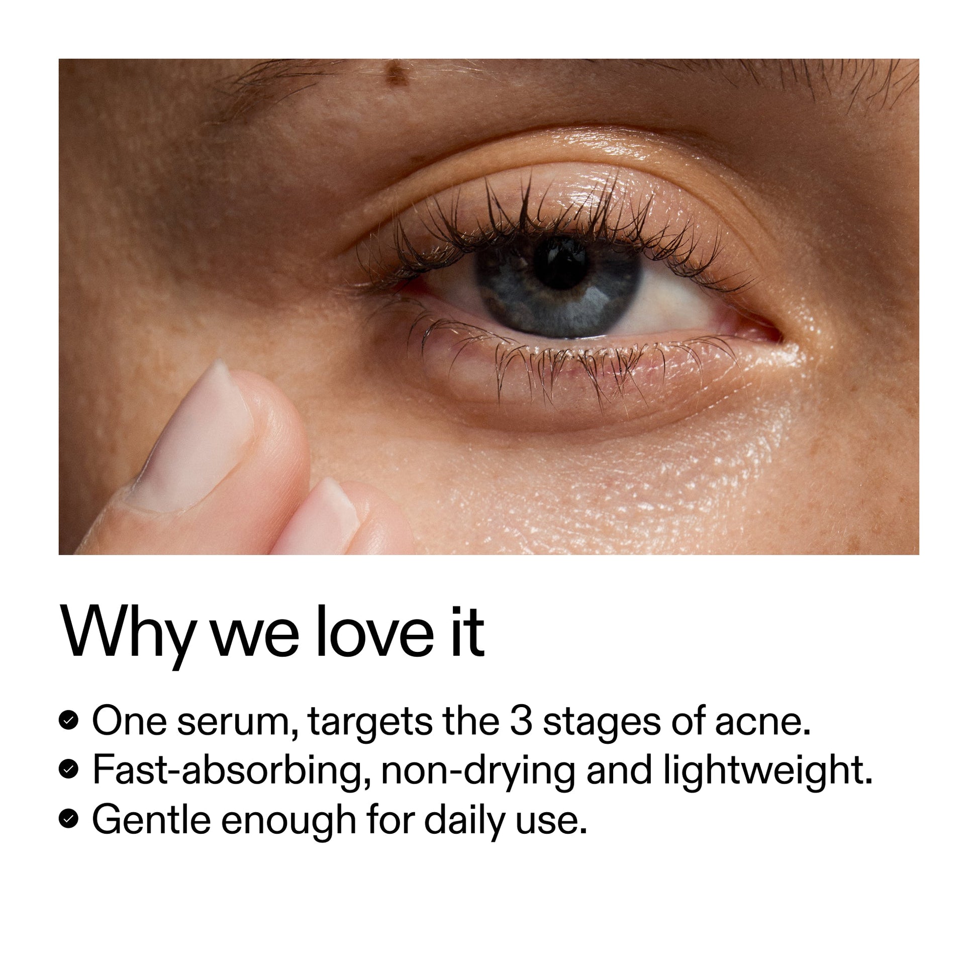 360-acne-clearing-duo-s9 Dioic_Whyweloveit_2000x2000_175aafd3-0cbe-403a-b317-a8362881bfe2.jpg