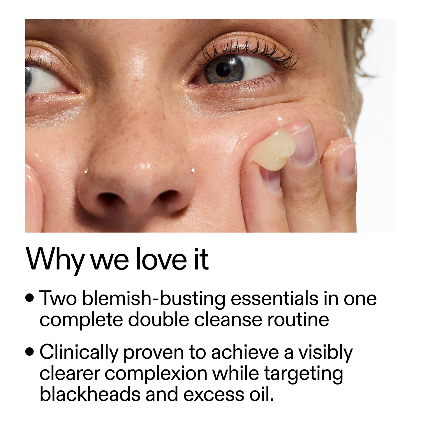 acne-double-cleanse-duo-u3 Double_Cleanse_Duo_for_Breakouts_Why_We_2000x2000_f242cb12-bb5c-487c-b203-071ccb406ec5.png