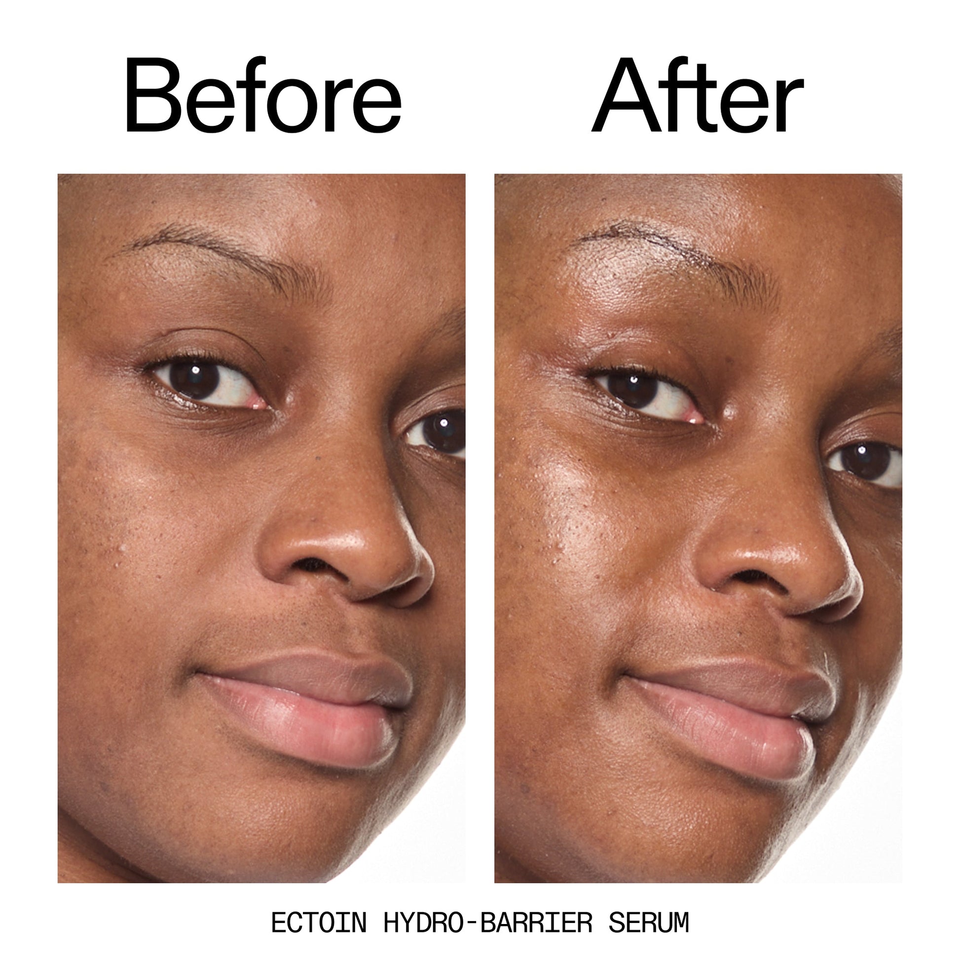 barrier-boosting-trio-z7 Ectoin_Before_After_2000x2000_ce35bc41-4da0-4b6f-adc7-29f8641f6c6c.jpg