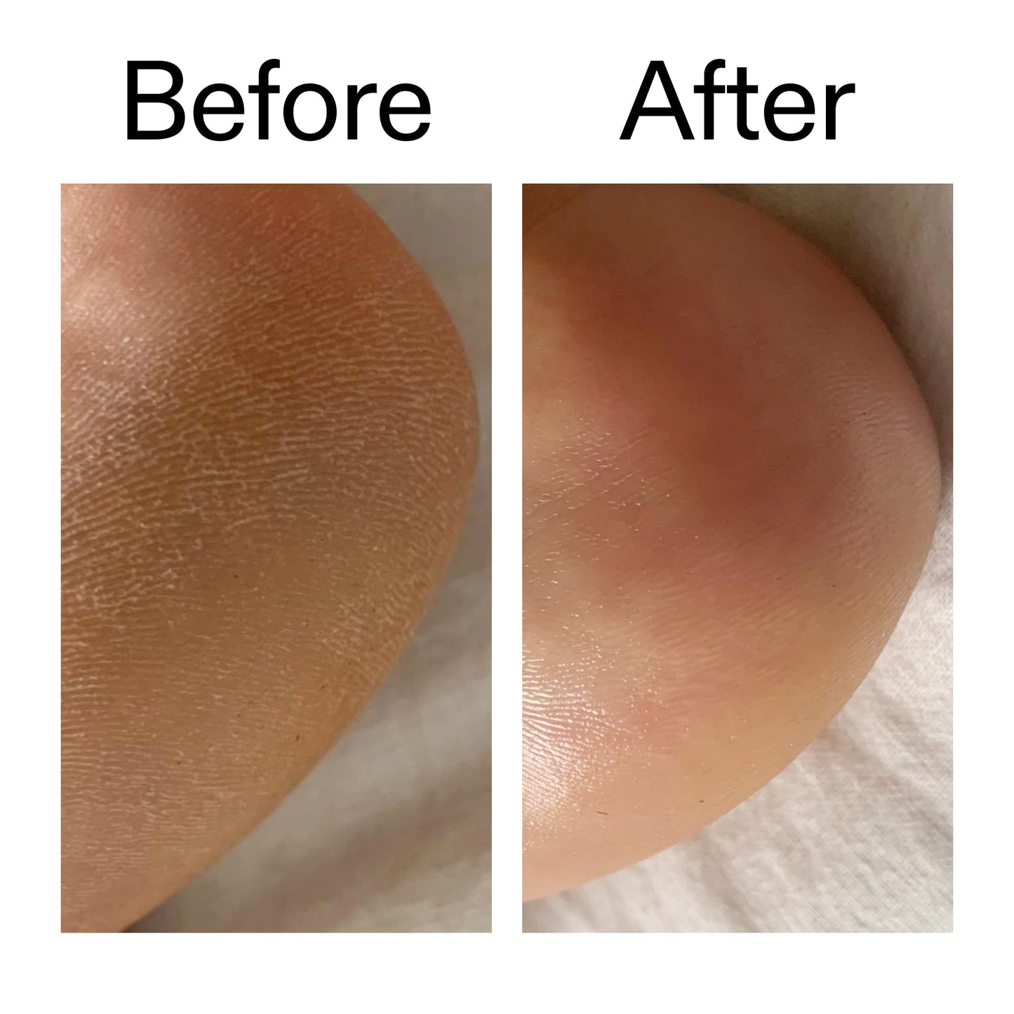 glycolic-acid-exfoliating-body-stick-duo-t7 Glycolic_Acid_Exfoliating_Body_Stick_Before_After_V1_2000x2000_a3043625-9400-429a-a7fb-d6dbd220f722.jpg