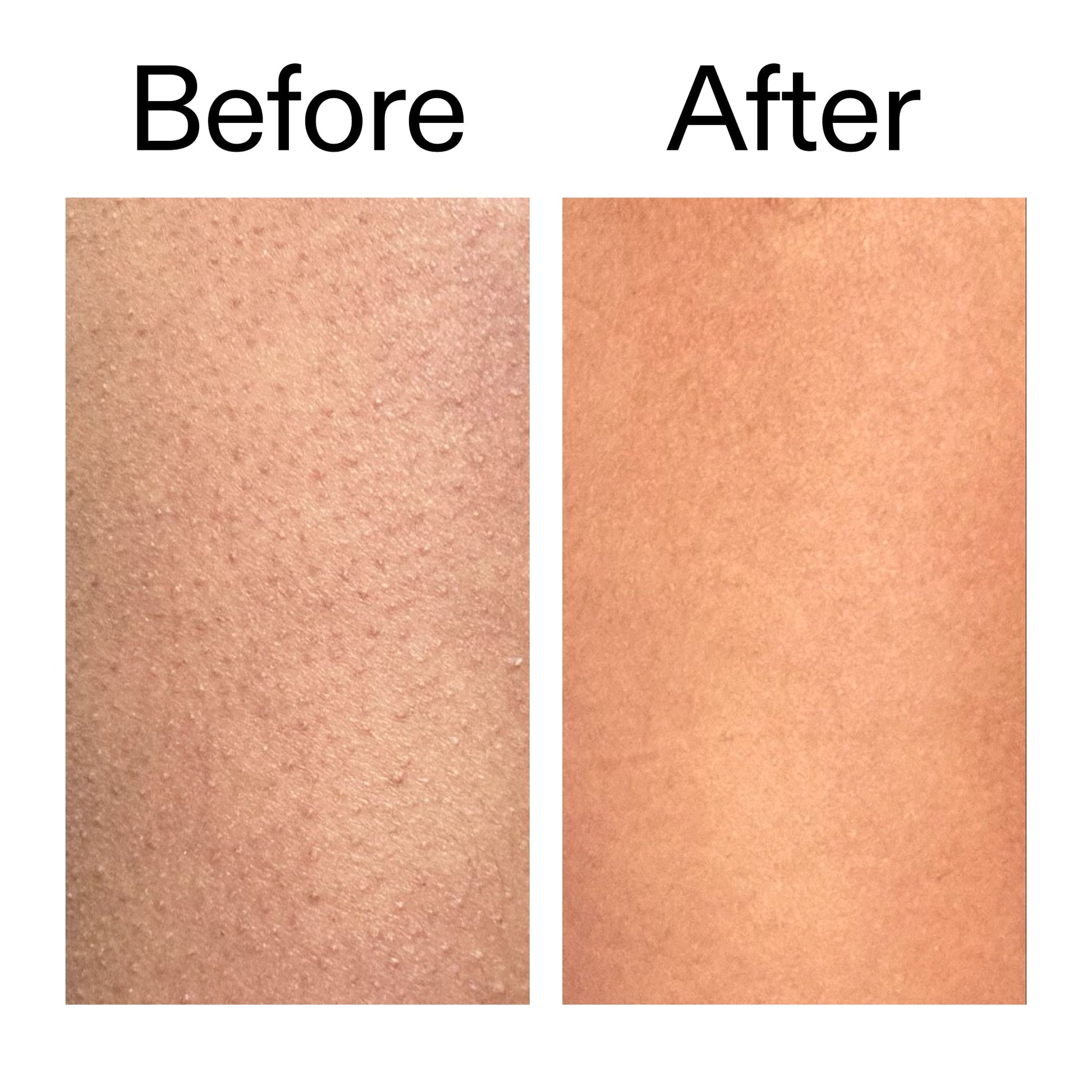glycolic-acid-exfoliating-body-stick-duo-t7 Glycolic_Body_Stick_B_A_2000x2000_6e6e6b4d-5bd7-43c0-aeed-4d66788e8995.jpg