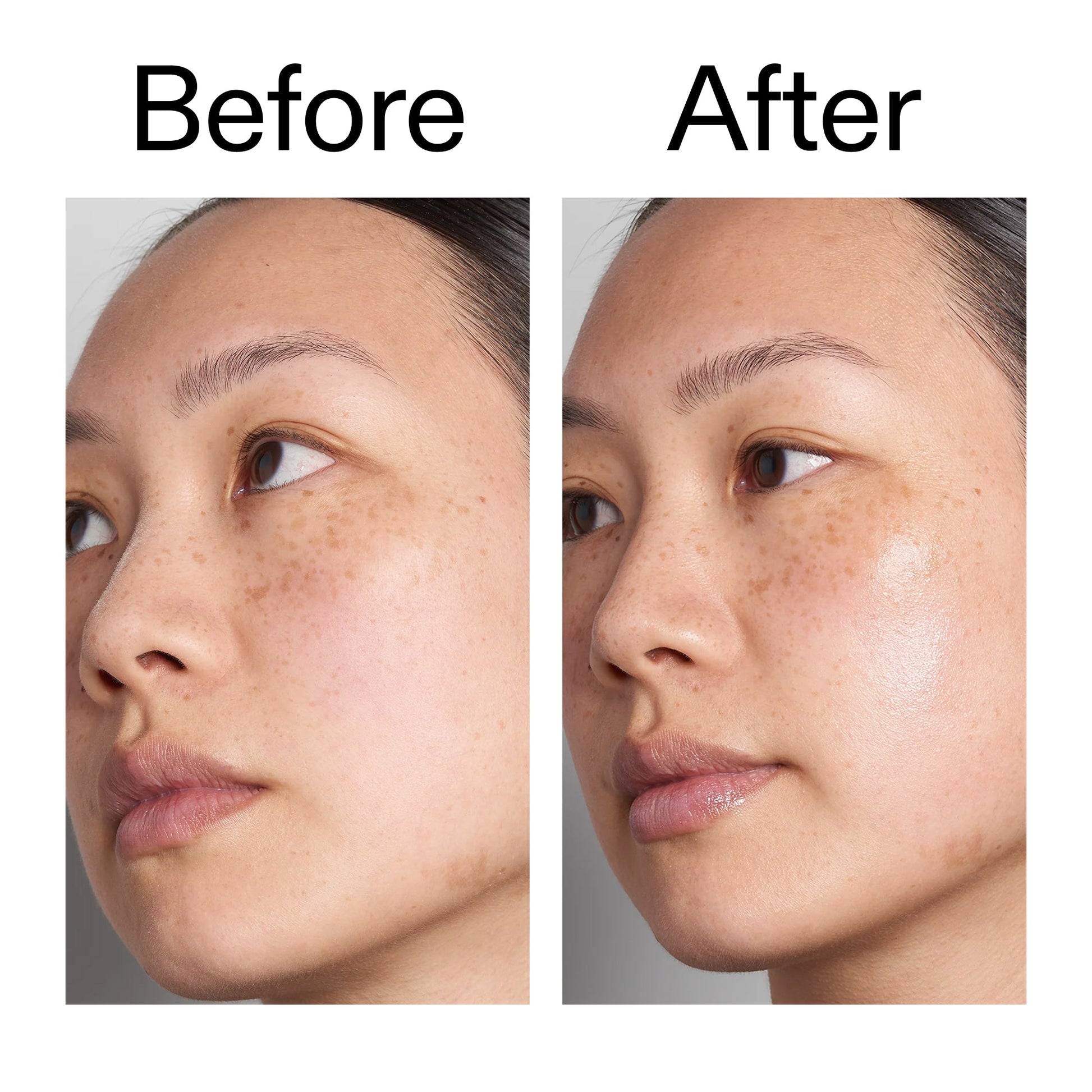 supersize-hyaluronic-acid-serum-100ml-c1 Hyaluronic_Acid_Before_After_2000x2000_d7983956-8aa2-4ea3-8255-c63e8d4f892e.jpg
