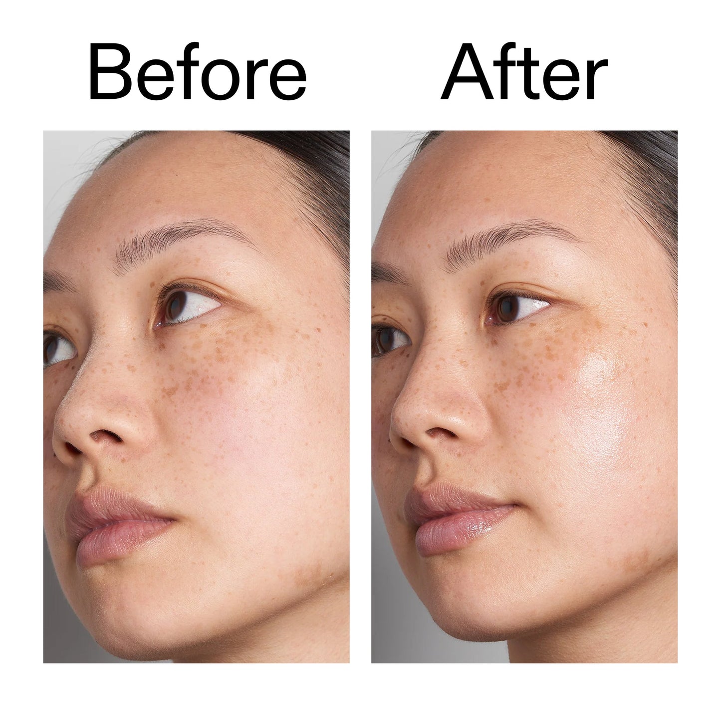 hyaluronic-acid-serum-60ml-r6 Hyaluronic_Acid_Before_After_2000x2000_d7983956-8aa2-4ea3-8255-c63e8d4f892e.jpg