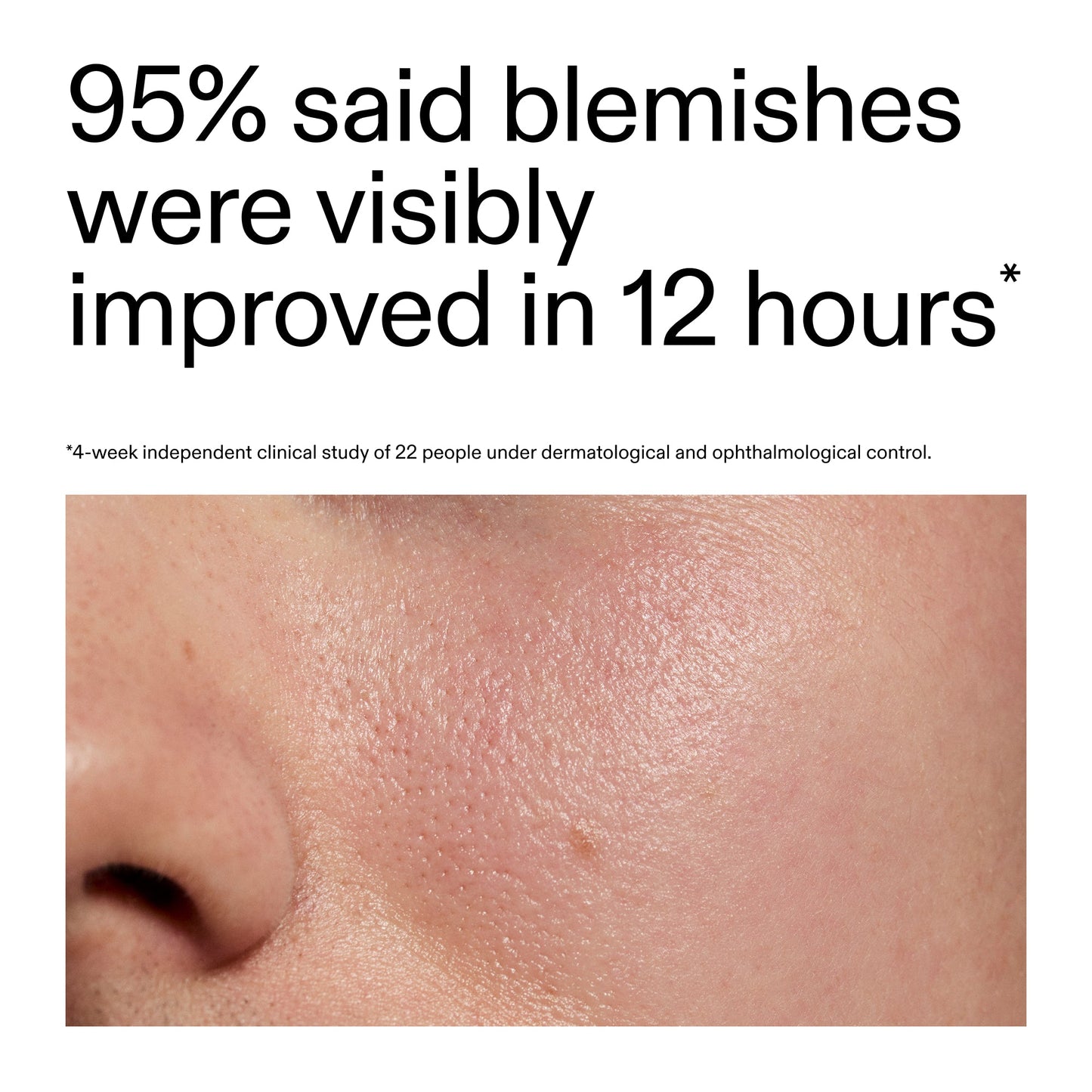 succinic-acid-acne-treatment-o4 Oat_Cleansing_Balm_Claim_2000x2000_ac6ce553-25db-41b2-a981-faae1ac4b8c0.jpg