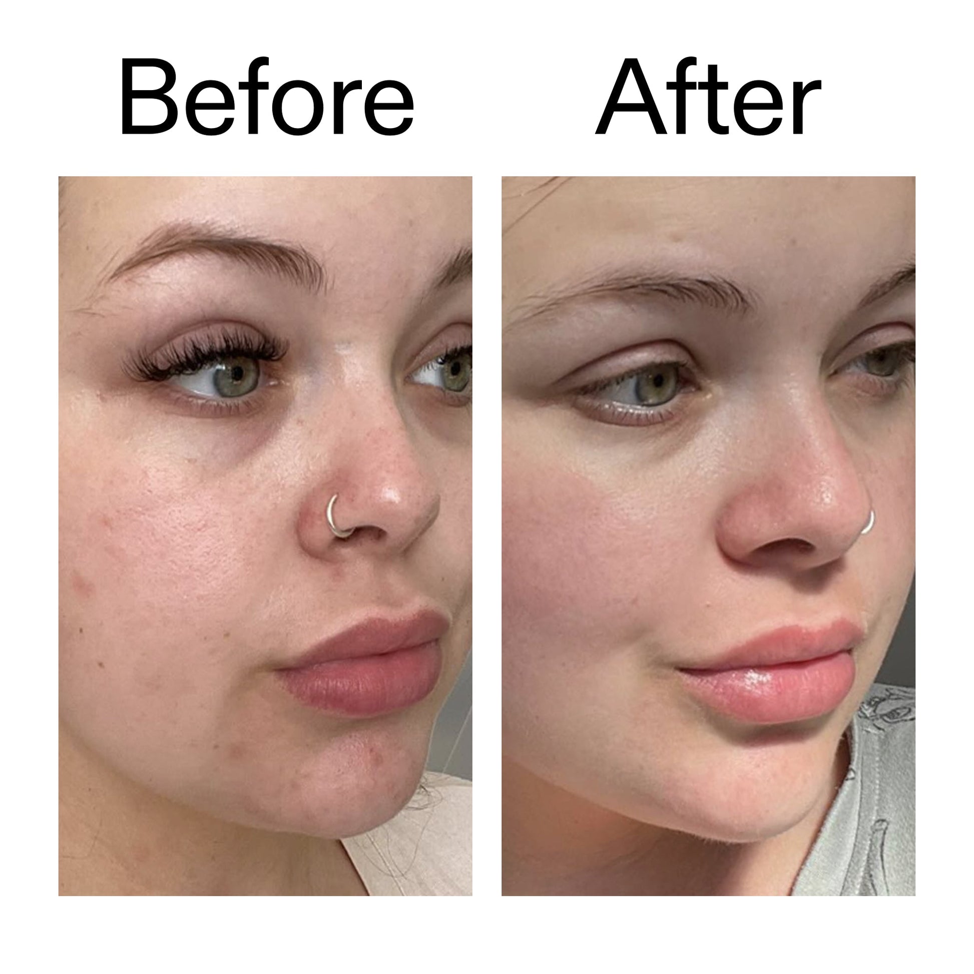 supersize-omega-water-cream-duo-j2 Omega50_Before_After_2000x2000_46483ed8-3f9d-487f-9a0c-9df79830bd65.jpg