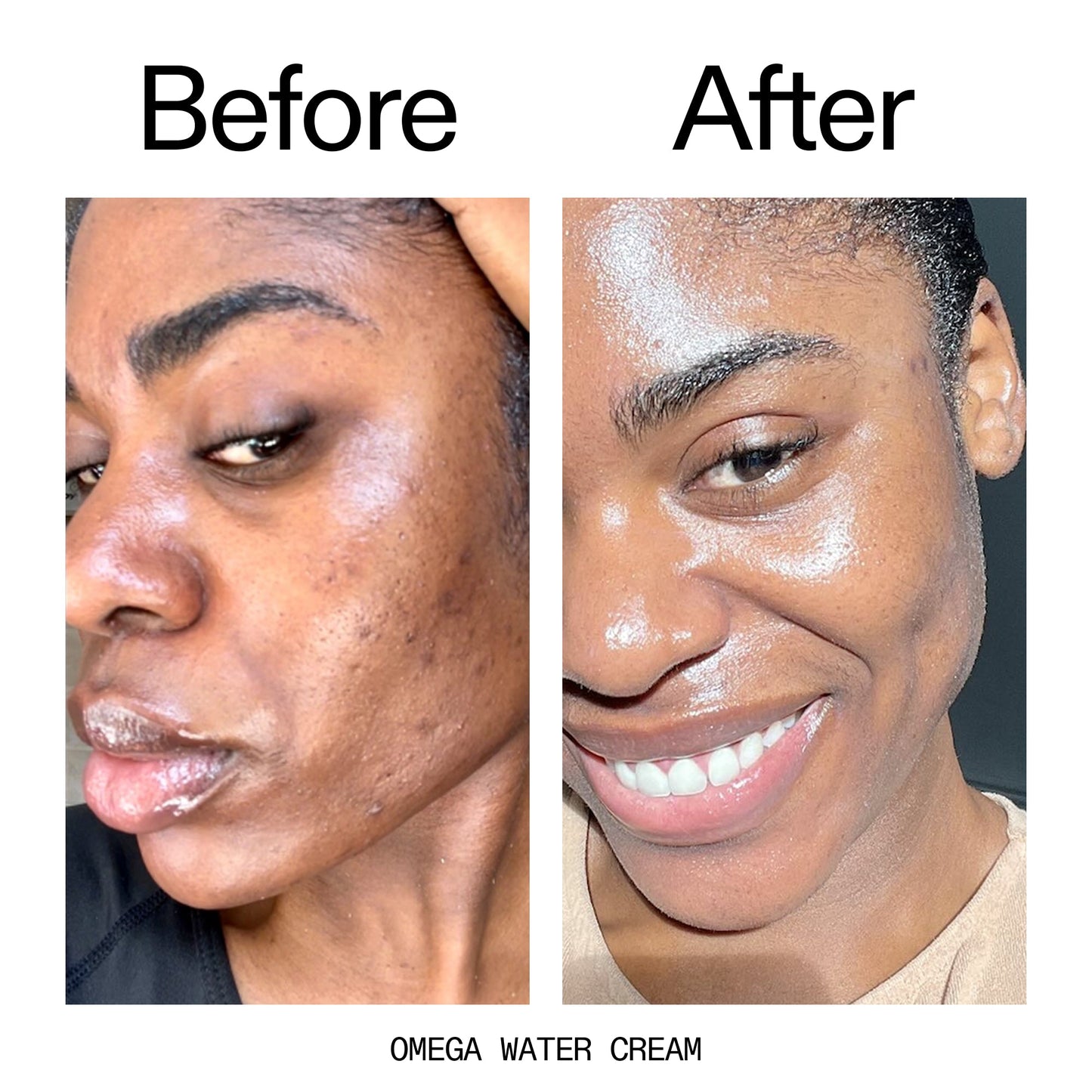 glowing-skin-set-x5 Omega_Water_Cream_Before_After_2000x2000_8e88278b-8c8d-48dc-ac77-4e98ebbd1b77.jpg