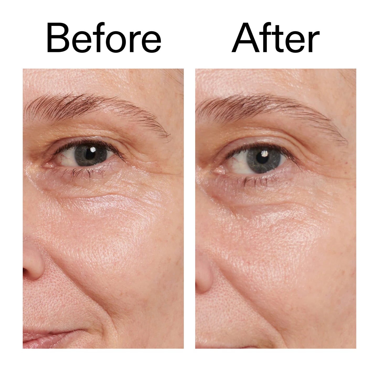 retinol-eye-cream-p9 Retinol_Eye_Cream_Before_After_2000x2000_ac03a80c-109e-4572-a95a-91dc109b4d27.jpg