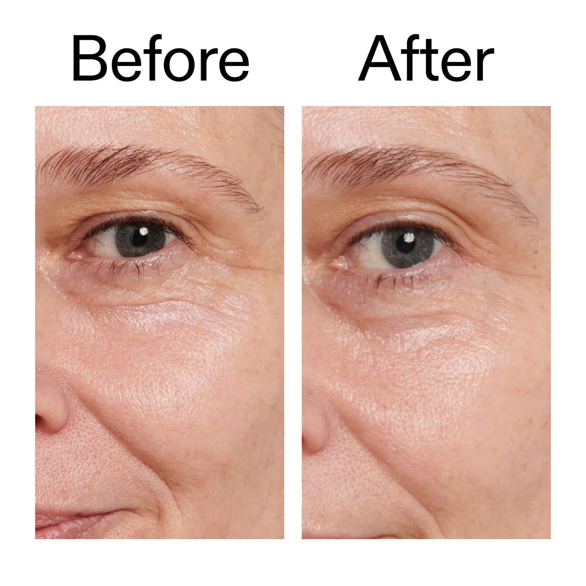 retinol-eye-cream-p9 Retinol_Eye_Cream_Before_After_2000x2000_ac03a80c-109e-4572-a95a-91dc109b4d27.jpg