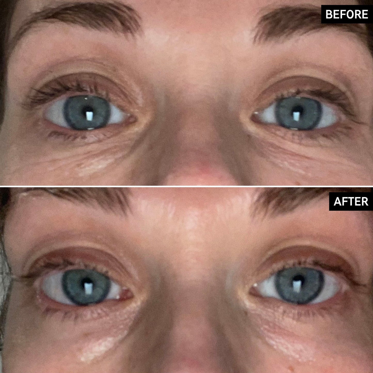 retinol-eye-cream-p9 SITE-UGCBAsApril_Nicole_B_A_PPage_2000x2000_1.jpg