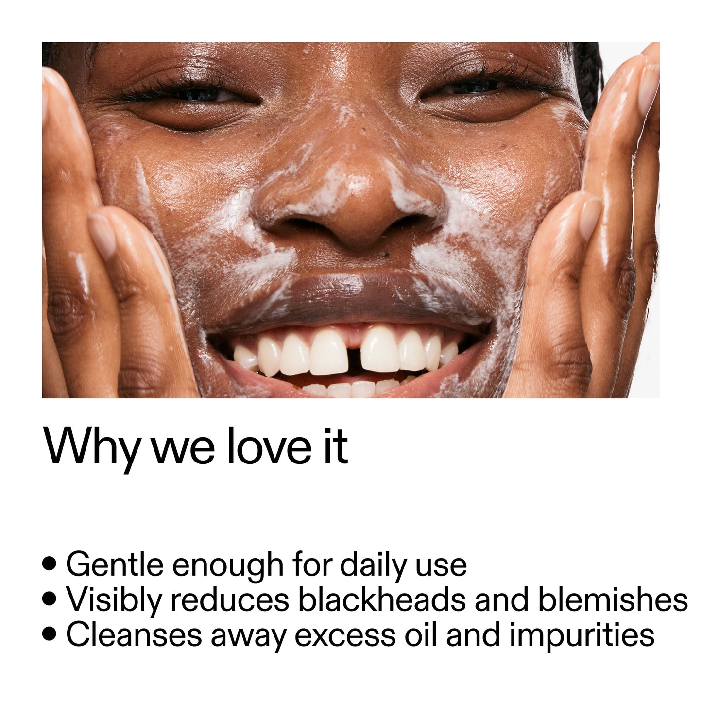 salicylic-acid-cleanser-duo-j2 Salicylic_Acid_Cleanser_-_300mlWhy_we_love_it_2000x2000_87dc92a9-2559-4309-98cd-4e570f1be735.jpg