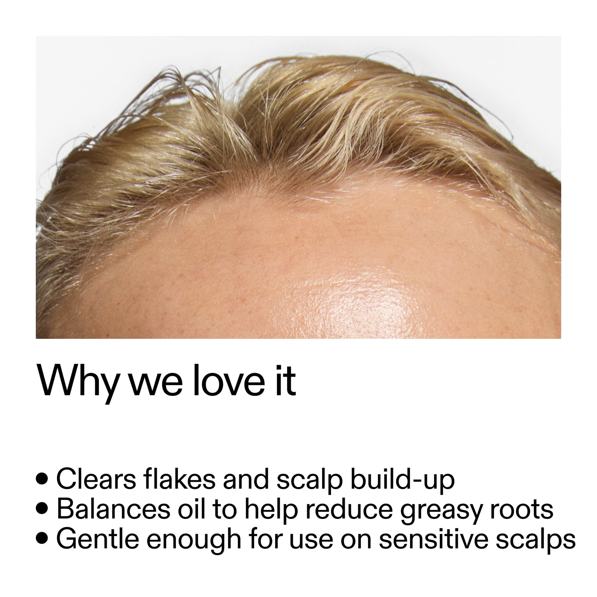 salicylic-acid-exfoliating-scalp-treatment-u7 Salicylic_Acid_Exfoliating_Scalp_Treatment_Why_we_love_it_2000x2000_44b6bd6d-9ec4-4b23-9dc4-bc3fd6f28e14.jpg