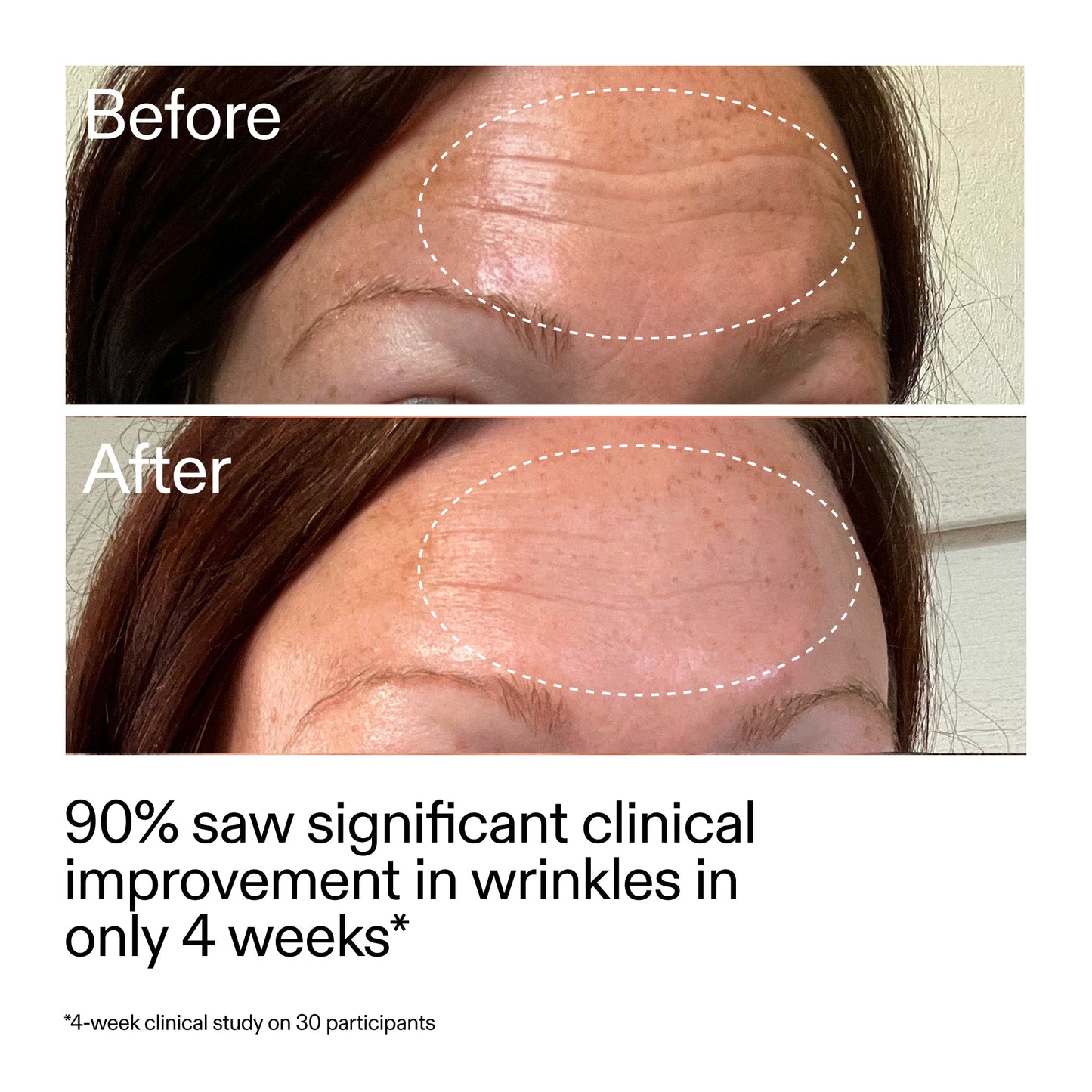 starter-retinol-serum-l9 StarterRetinol_BeforeAfter_Claim1_2000x2000_a09b50b6-4688-4527-abae-21bd142b89b7.jpg