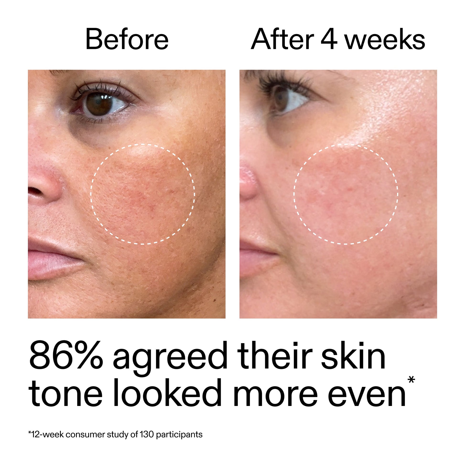 starter-retinol-serum-l9 StarterRetinol_BeforeAfter_Claim2_2000x2000_f5c9ecc0-8d76-429d-bef5-c3a61bcf5c09.jpg