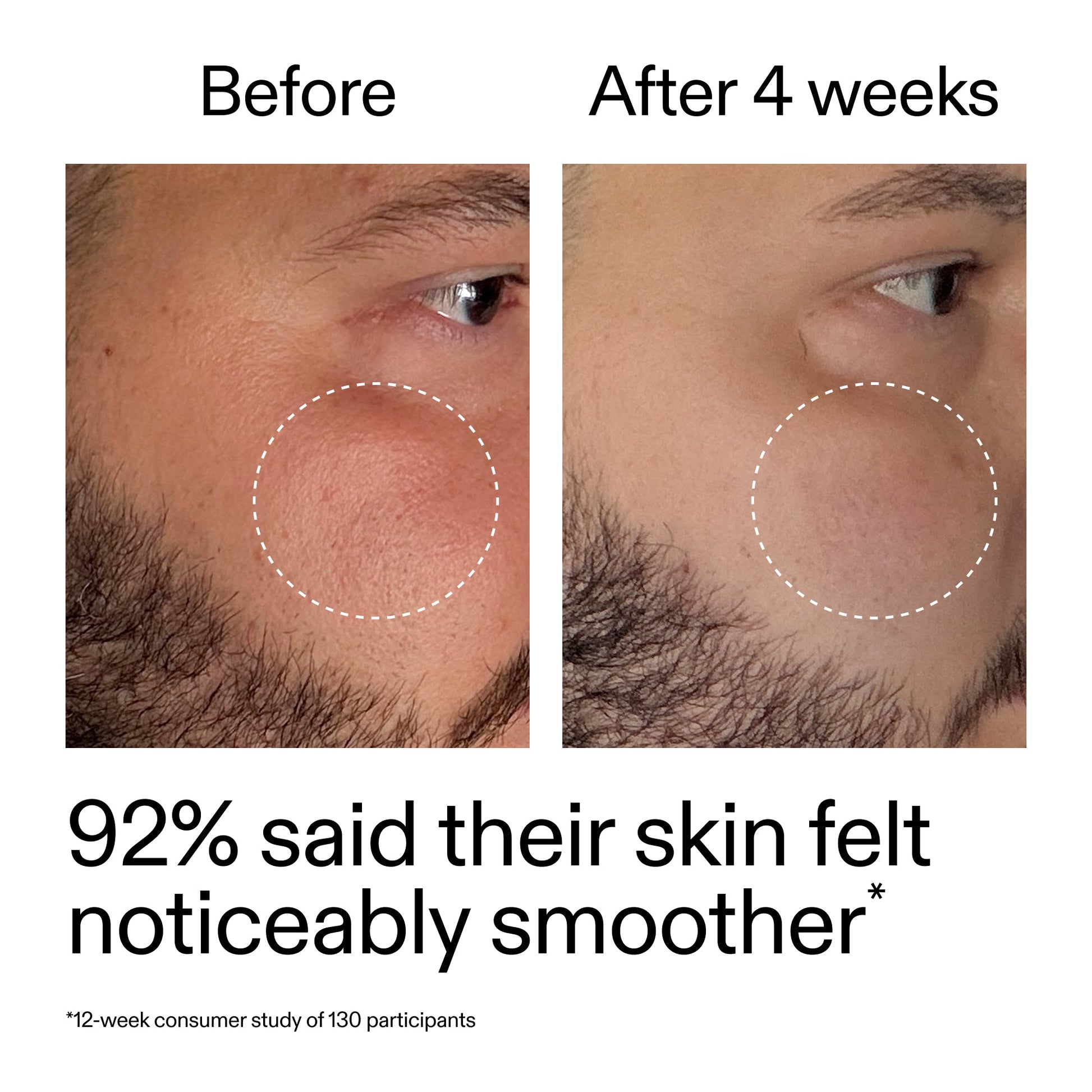 starter-retinol-serum-l9 StarterRetinol_BeforeAfter_Claim3_2000x2000_6ceab106-e0ee-4ed4-ba62-41bc39538038.jpg