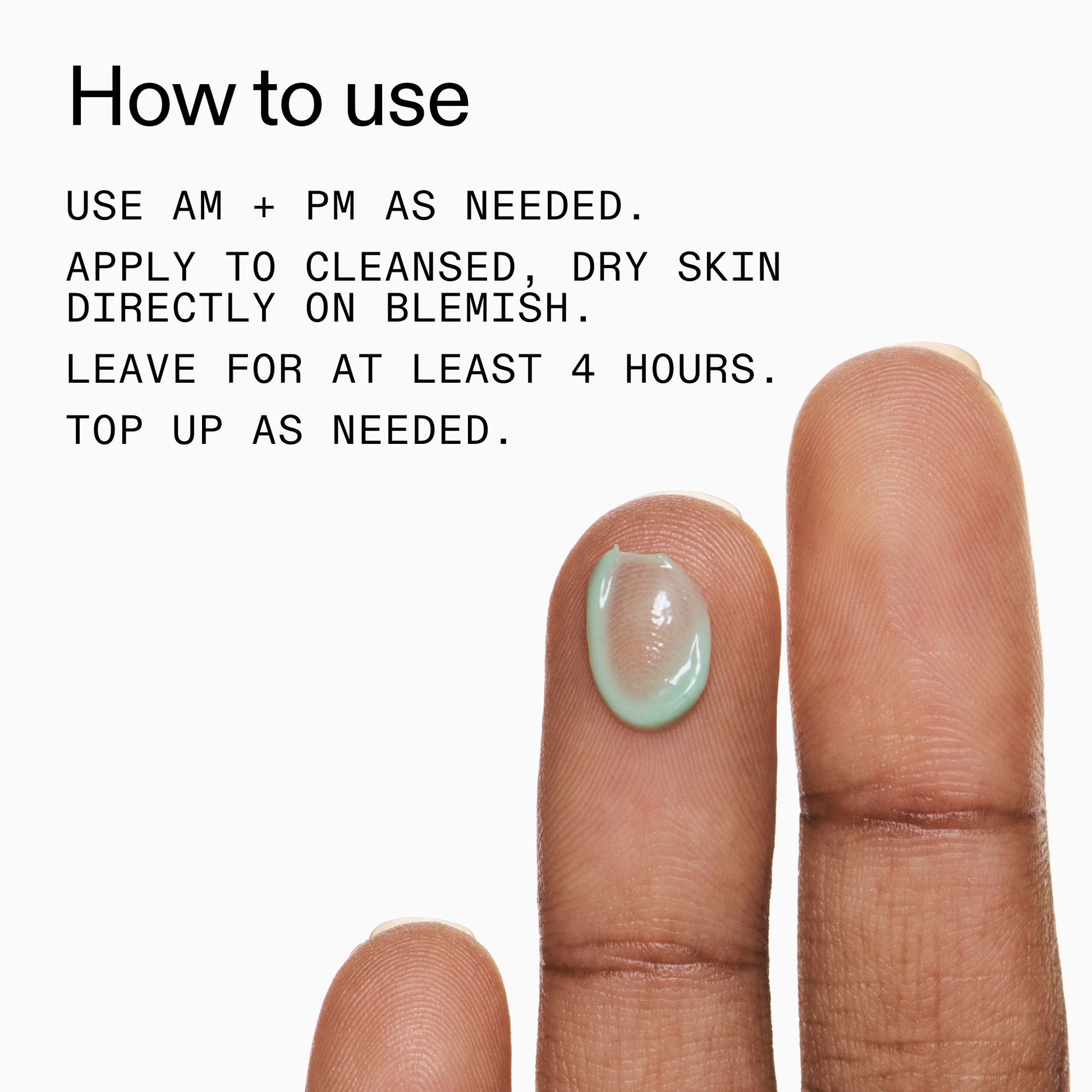 succinic-acid-acne-treatment-o4 Succinic_Acid_Treatment_How_to_Use_2000x2000_d57137d5-d7f1-427c-9a46-5fc00c19c542.jpg