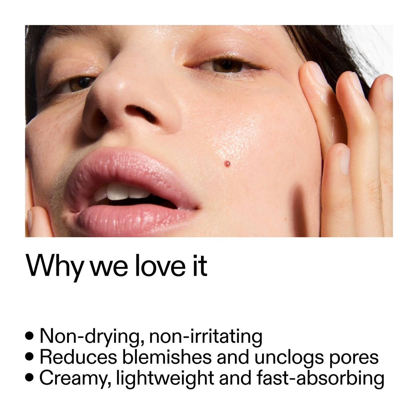 succinic-acid-acne-treatment-o4 Succinic_Acid_Treatment_Why_we_love_it_2000x2000_e90dd42a-cfe9-48b5-a2c7-d5eda787a6a8.jpg