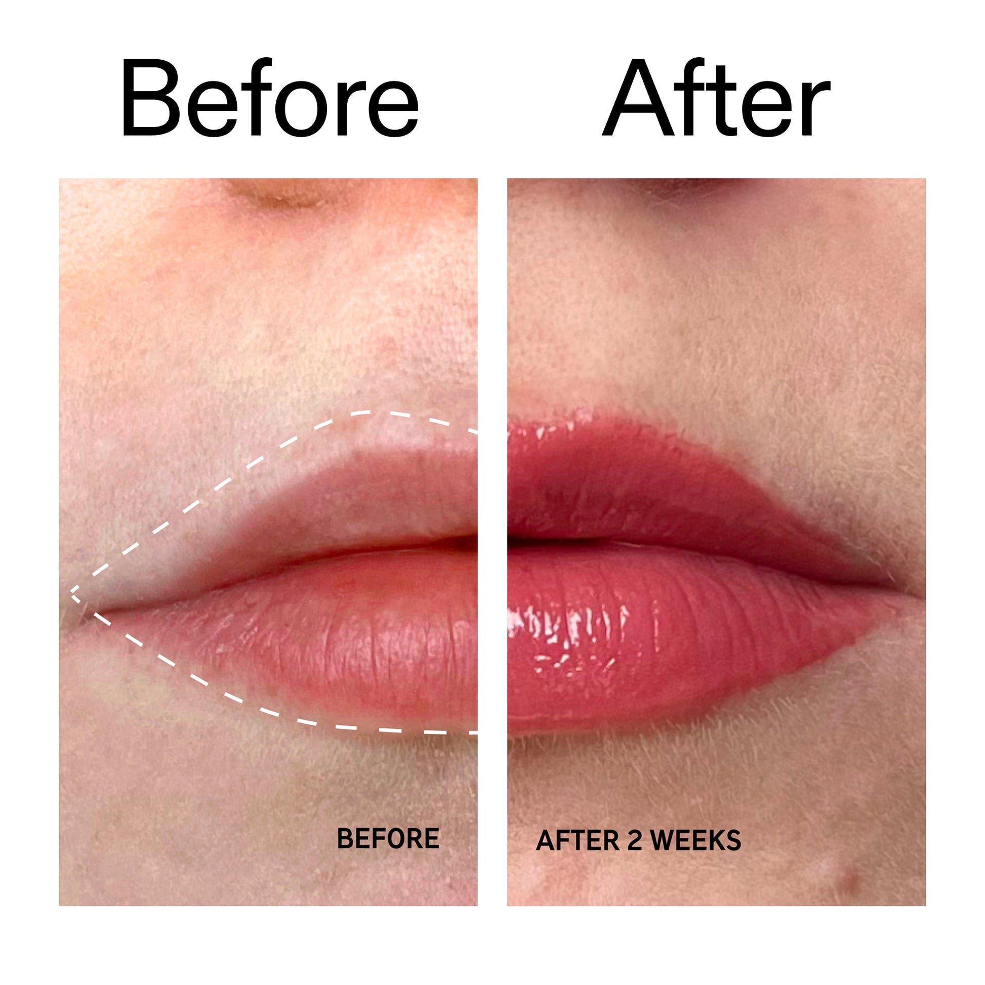 tripeptide-plumping-berry-lip-balm-m7 Tripeptide_Plumping_Lip_Balm_-_Berry_Before_After_2000x2000_9474bbd8-43ca-4b0e-b0e7-dfab70b91927.jpg