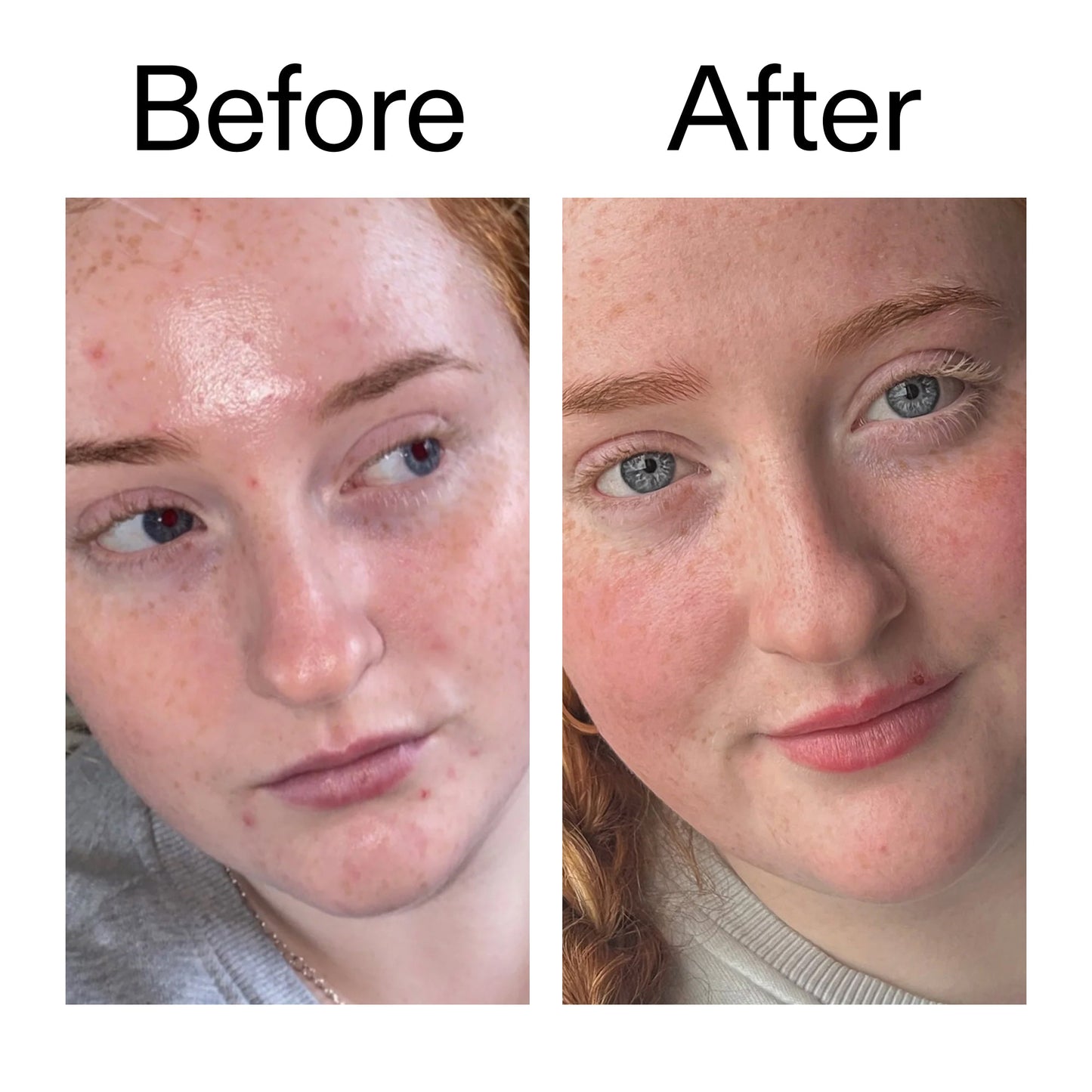 vitamin-b-c-and-e-moisturizer-d4 Vitamin_B_C_and_E_Moisturizer_Before_After_2000x2000_b0781a76-5ad2-4be9-95b8-ef92b356833c.jpg